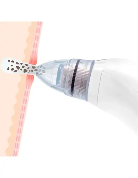 A Tres Click | Extractor De Espinillas XN -8030 / Acné $ 41.286 $ 24.286 Generic Kits de Limpieza 