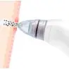 atresclick.com | Extractor De Espinillas XN -8030 / Acné